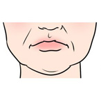 ほうれい線